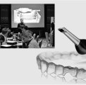Prosthetic Planning and Digital Workflow in Hybrid Prosthetic Restorations