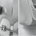 Sinus Lift Bone Applications and Piezo Surgery